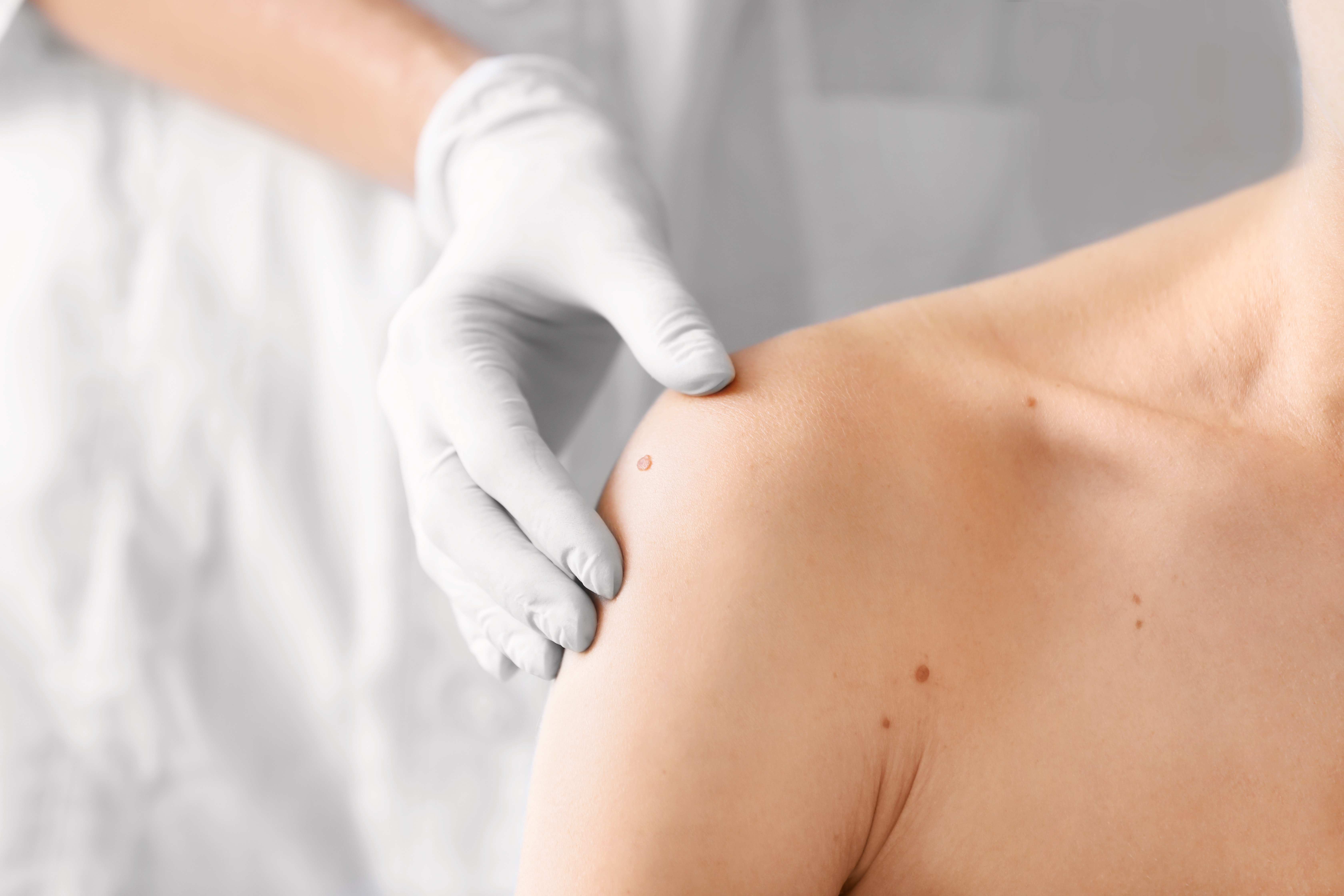 RC Professionale e Tutela Legale Dermatologo